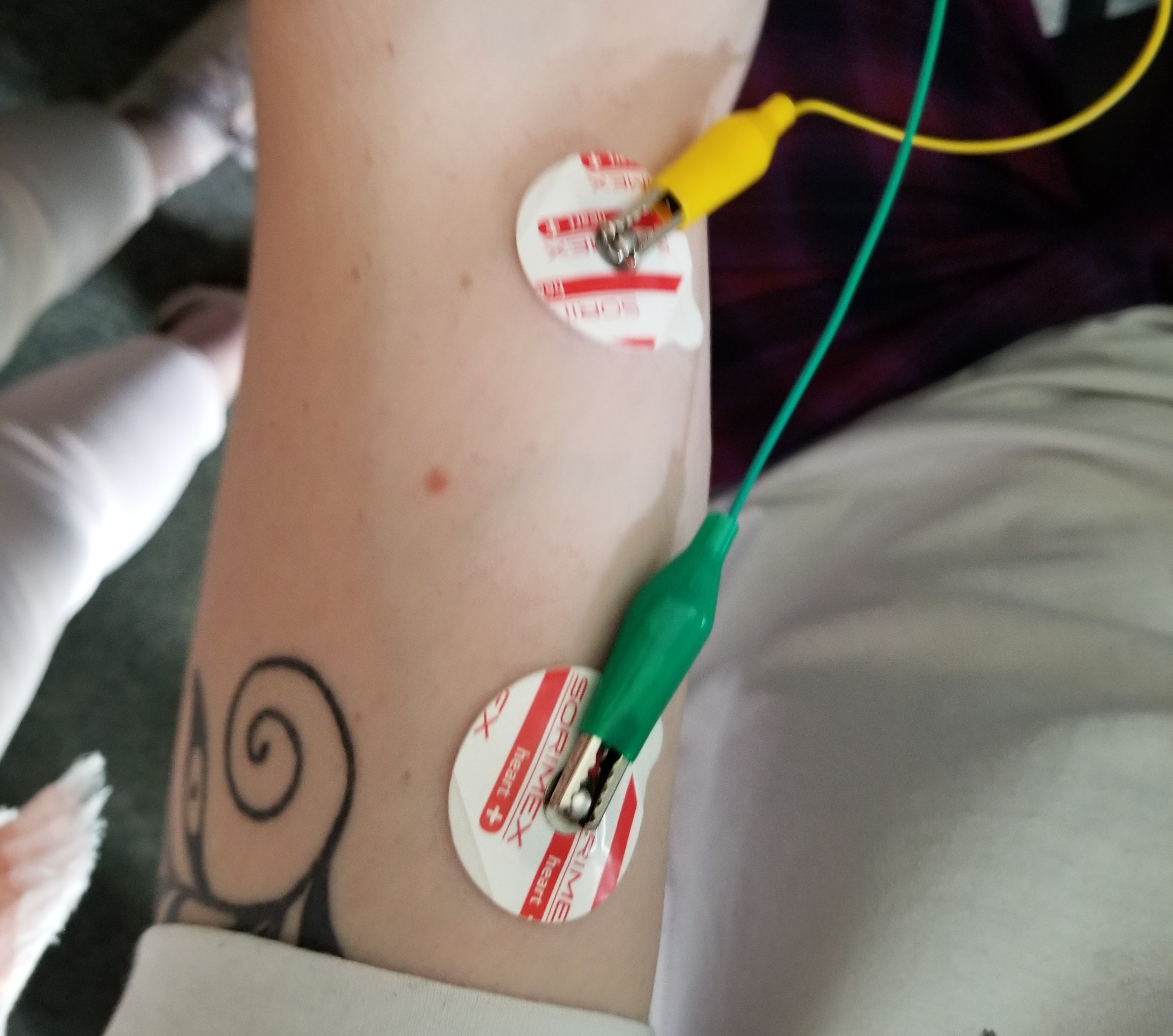 Electrodes collecting EMG signal from arm muscles